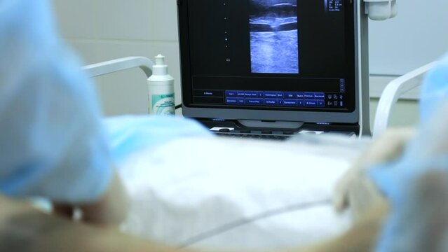 During radiofrequency coagulation, surgeon controls process inserting catheter into vein on ultrasound monitor device. Ultrasound monitoring introduction catheter into vein in treatment varicose veins