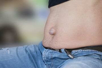 Person organ of the navel are abnormal, the skin surface of the abdomen.