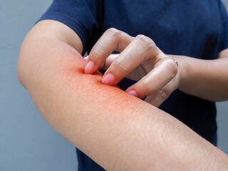 Clopped image of woman are itching and scratching of skin diseases.