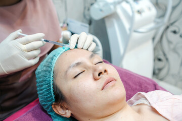 Chemical injections for facial skin care on the forehead of an Asian woman, in a beauty clinic.