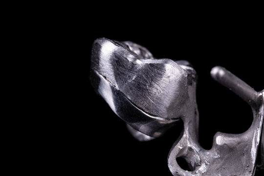 Interlocking metal parts of a crown and a denture