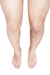 Comparison of shaved leg and unshaven leg