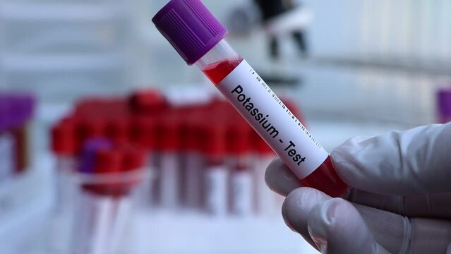 Potassium test to look for abnormalities from blood,  blood sample to analyze