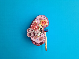 Human kidney model concept of timely treatment of kidney stones