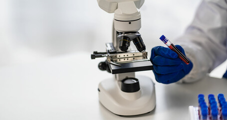 Professional doctor examining arterial blood sample, professional research in nurse with microscope Close up of blood test tube held by female lab assistant in lab office