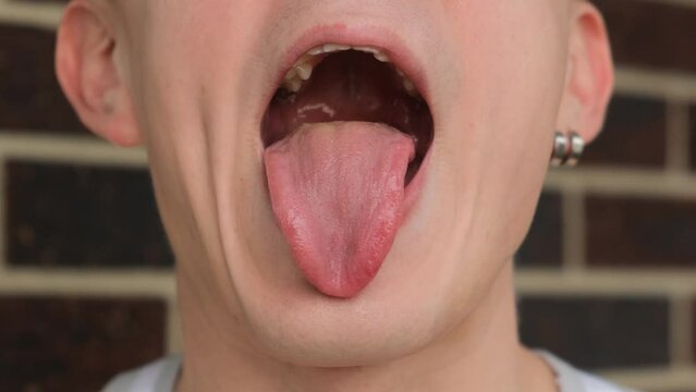 A man shows a healthy pink tongue, close-up
