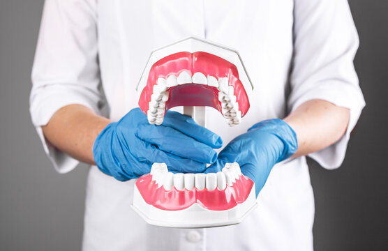 Dentist with open teeth jaw model in hand. Dentistry and stomatology concept. High quality photo