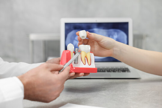 Doctor showing patient educational model of dental implant in clinic, closeup