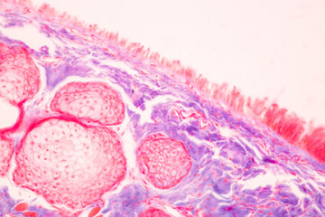 Characteristics Tissue of Optic nerve Human, Cornea from eye Human and Eyelid Human under the...