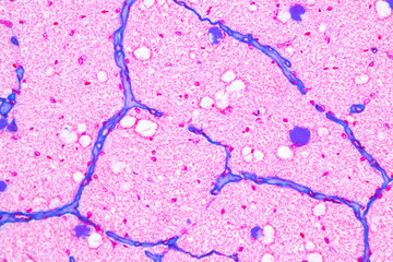 Characteristics Tissue of Optic nerve Human, Cornea from eye Human and Eyelid Human under the...