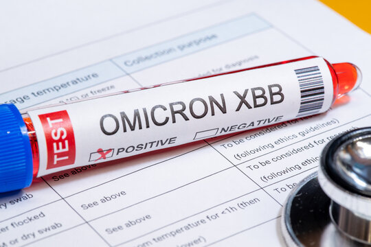 Test tube labelled "COVID-19 OMICRON XBB variant test positive"