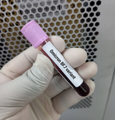 Blood sample for Omicron BF.7 variant test. New variant of the SARS-CoV-2 coronavirus. Subvariant of Omicron. Coronavirus.