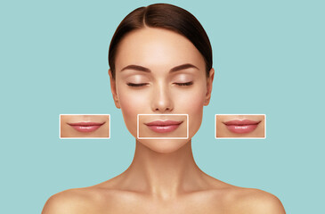 Hyaluronic acid injection. Women lips correction before and after comparison. Beauty lip treatment...