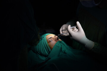 rhinoplasty surgery, defects in the shape of the nose in the female patient. Surgical intervention...