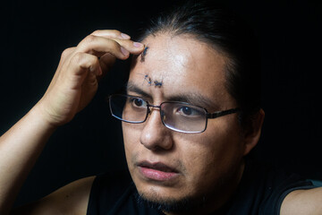 portrait of latino man with 6 stitches on his forehead, touching his wound, having a scared expression