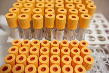 Blood sample tube from a shelf with analysis machines in the laboratory background. tubes prepared in laboratory centrifuge machine blood bank.