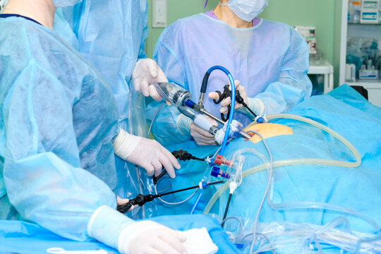 Hands of surgeons in sterile gloves with laparoscopic surgical manipulators during proctologic surgery.