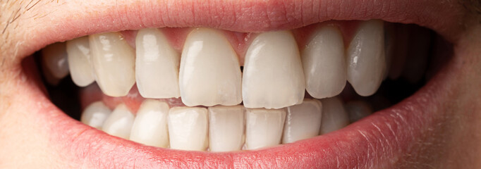 Close up of clean teeth