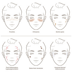 6 types of facial age spots.  Vector illustration drawing.