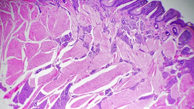 Human palatine tonsil filmed under microscope with high magnification 40x for medical issues. Investigating diseases and affected organs of the oral cavity. Research of people anatomy concept