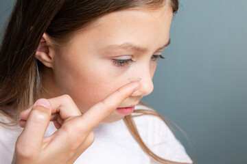 Little child girl inserting a transparent contact lens into her eye on gray background. The concept...