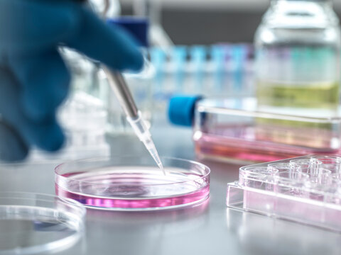 Scientist pipetting medical samples into petri dish in laboratory