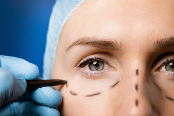 surgeon preparing woman's face for plastic surgery. facelift procedure