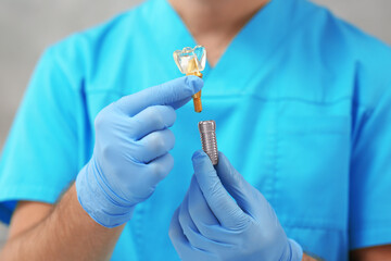 Dentist holding educational model of dental implant on blurred background, closeup - obrazy, fototapety, plakaty