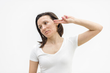 Photo of woman with dry skin touching her face on white background.