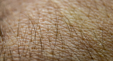 Macro human skin texture. Closeup skin pattern. Medicine healthy surface background. Dermatitis concept