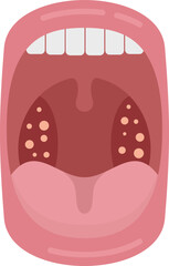 Mouth disease icon flat vector. Bacterial anatomy. Ent inflammation isolated