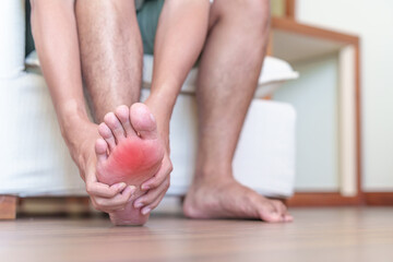 man having barefoot pain due to Plantar fasciitis and  bunion toes or blister due to wearing narrow...