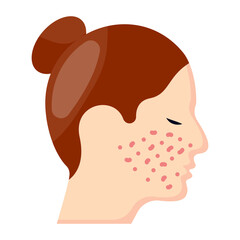 Skin Resurfacing or Microdermabrasion vector icon design, beauty and personal care symbol, cosmetics and dermatologist sign, body aesthetics stock illustration, Acne Treatment concept