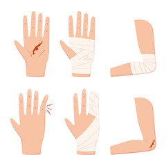 Set of Hand, Palm, Elbow, Finger and Arm Injury with Blood and Bandage Isolated on White Background. First Aid, Health