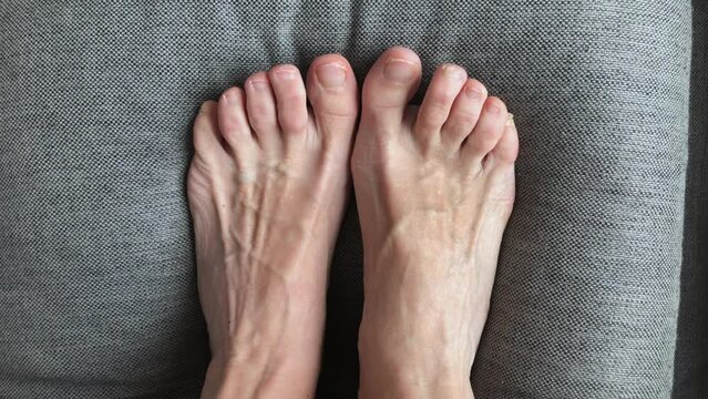 Toes problem nails. Top view