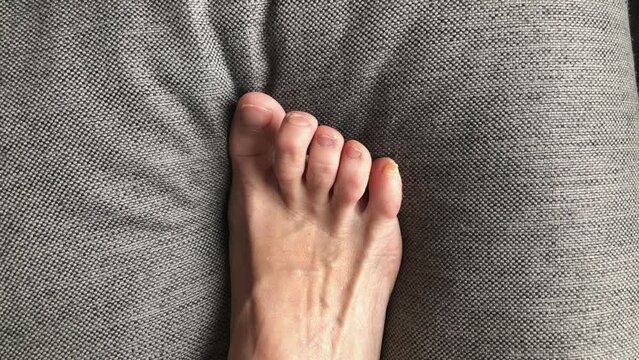 toes deformation of the nail. Top view