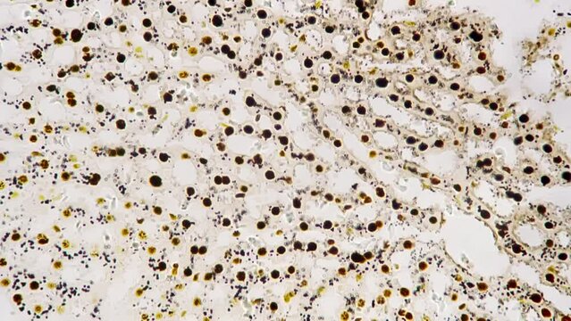 Human cholangiole in section under microscope with 400x magnification on bright field. Isolated macro view of intrahepatic bile ducts. People anatomy research held in biological lab. Medicine concept.