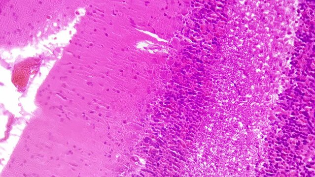 High magnification of human cerebellum 400x in section shown on white background. Isolated macro sample of people brain part playing the role of motor control. Studying functions of coordination theme