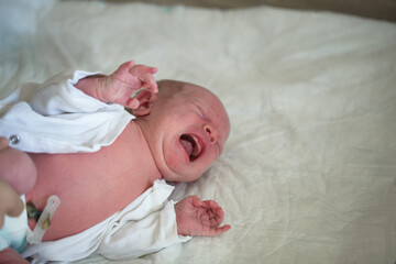 healing umbilical cord.crying newborn baby lies on the bed on the face allergic