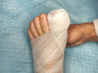 Covering with medicine bandage injury foot with hurt big toe