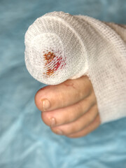 Leg of the bite victim is tied with white  sterile bandage.