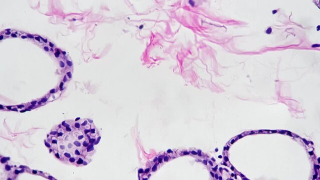 Thyroid gland of the human in section filmed under microscope 400x against bright field. Macro view of cells of people organ located on neck and responsible for hormone secretion. Learning anatomy