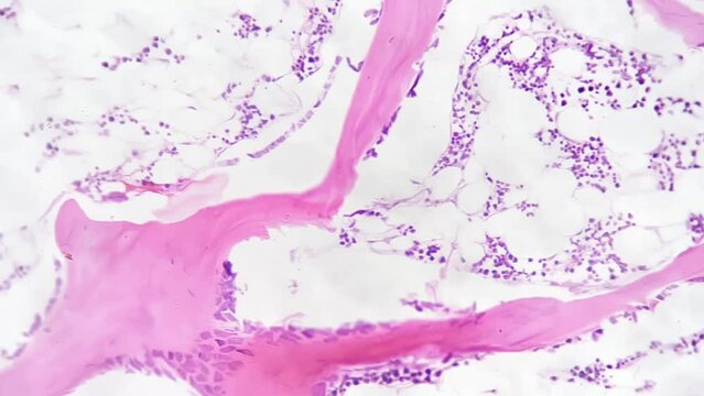 Human joint filmed under microscope with high magnification 200x against white background. Scientific macro pattern of connection made between people bones which function is linking skeletal system.