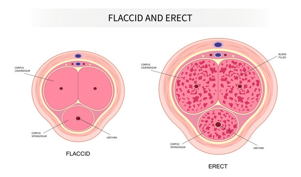 neurogenic hormones disorder of the Peyronie's disease Erectile dysfunction and mental depression erect traumatic cardiovascular level drug