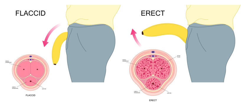 Hormones and the Peyronie's disease erect mental depression traumatic cardiovascular level drug neurogenic disorder