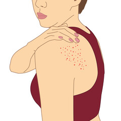 Women's shoulders back have a rash itch because of allergies symptoms or nettle or eczema, illustration cartoon on white background