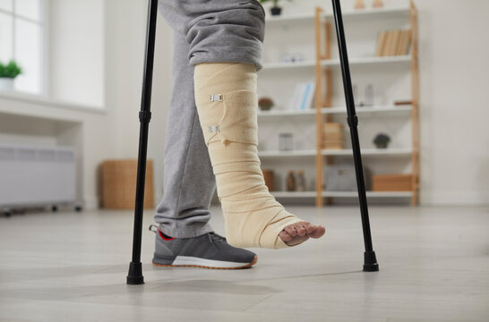 Man with a broken leg walking with crutches. Unrecognizable male patient with an injured ankle in a bandage walking with crutches at home. Close up of human feet on the floor. Concept of injury