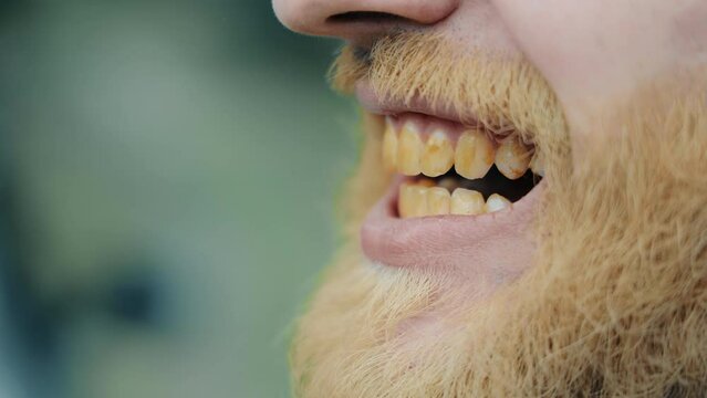 A make-up artist makes up a man's teeth, close-up. Yellow dirty teeth of a man