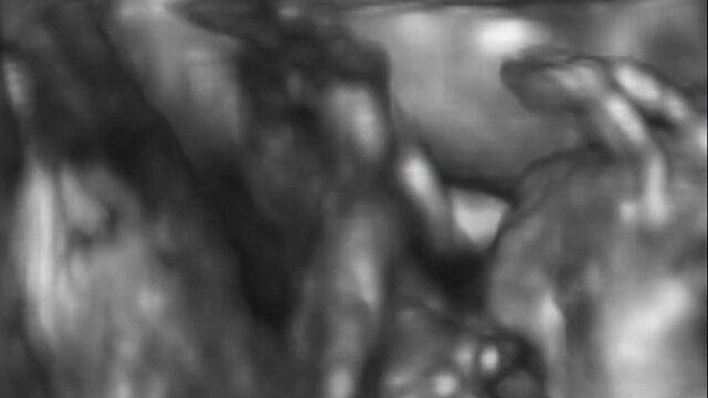 Three-dimensional ultrasound of a small baby at 12 weeks. 12 weeks pregnant ultrasound echography showing baby or fetus development and pregnancy health checking