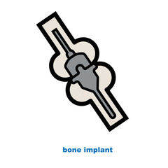 bone implant. isolated on white background.
